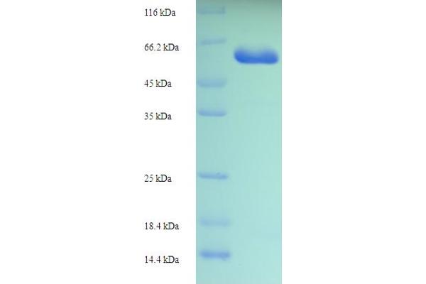 CPA6 Protein (AA 130-437) (His-SUMO Tag)