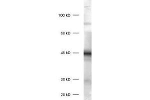 dilution: 1 : 1000, sample: brain homogenate of newborn rats (P1) (Doublecortin Antikörper)