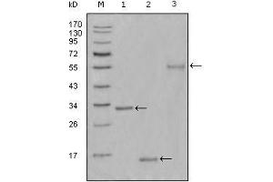 Western Blot showing Ki67 antibody used against truncated Trx-Ki67 recombinant protein (1),truncated Ki67 (aa3118-3256)-His recombinant protein (2) and truncated Ki67 (aa3118-3256)-hIgGFc transfected CHO-K1 cell lysate (3). (Ki-67 Antikörper  (AA 3118-3256))
