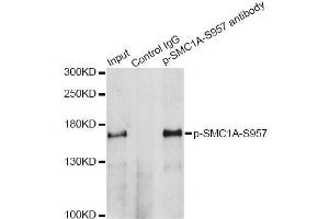 Immunoprecipitation analysis of 200 μg extracts of HeLa cells treated by UV using 2. (SMC1A Antikörper  (pSer957))
