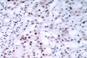 Image no. 2 for anti-Tumor Protein P53 (TP53) antibody (ABIN272050) (p53 Antikörper)