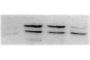 Western Blotting (WB) image for anti-Mitogen-Activated Protein Kinase 8 (MAPK8) antibody (ABIN126827) (JNK Antikörper)