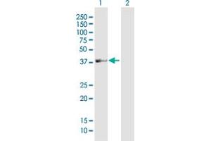 Western Blot analysis of LOC113179 expression in transfected 293T cell line by LOC113179 MaxPab polyclonal antibody. (ADAT3 Antikörper  (AA 1-351))