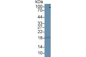 Western blot analysis of Rat Lymph node lysate, using Rat CD3d Antibody (1 µg/ml) and HRP-conjugated Goat Anti-Rabbit antibody ( (CD3D Antikörper  (AA 22-106))