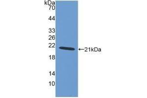 Detection of Recombinant AIF1, Human using Polyclonal Antibody to Ionized Calcium-binding Adapter Molecule 1 (IBA1) (Iba1 Antikörper  (AA 1-147))