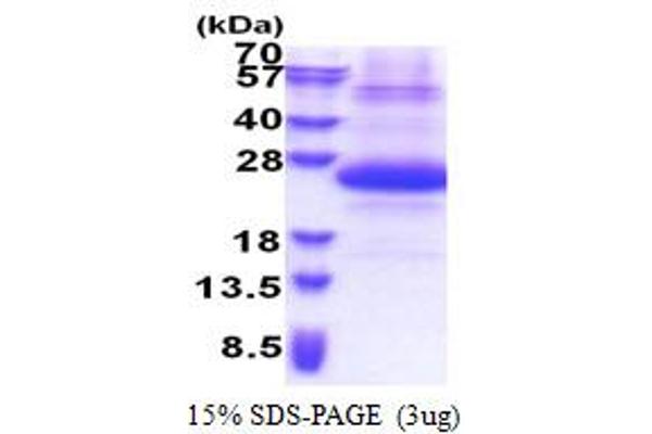 SSSCA1 Protein (AA 1-199) (His tag)