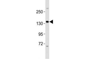 Western blot testing of ERBB4 antibody at 1:2000 dilution + MCF-7 lysate (ERBB4 Antikörper  (AA 1141-1166))