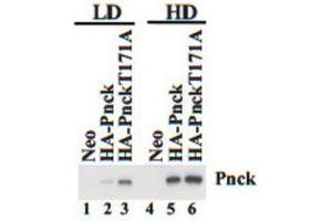 Western Blotting (WB) image for anti-Pregnancy Up-Regulated Non-Ubiquitously Expressed CaM Kinase (PNCK) antibody (ABIN3002987) (PNCK Antikörper)