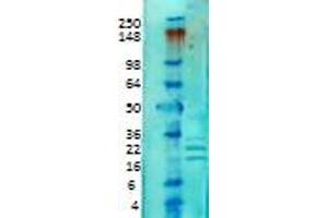 KCHIP Western Blot. (KCNIP1 Antikörper)