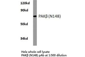 Western blot (WB) analysis of PAKβ antibody in extracts from hela cells. (PAK3 Antikörper)