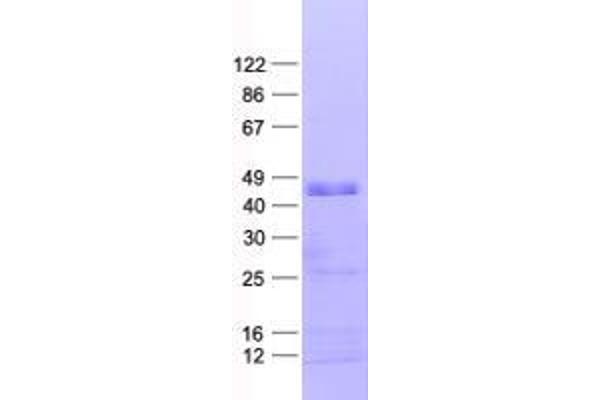 ZNF3 Protein (His tag)