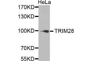 Western Blotting (WB) image for anti-Tripartite Motif Containing 28 (TRIM28) (AA 576-835) antibody (ABIN6219466) (KAP1 Antikörper  (AA 576-835))