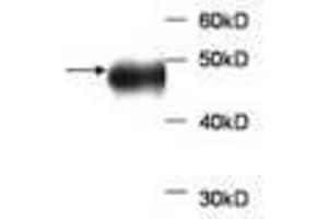 Image no. 1 for anti-Aldolase B, Fructose-Bisphosphate (ALDOB) antibody (ABIN791520) (ALDOB Antikörper)