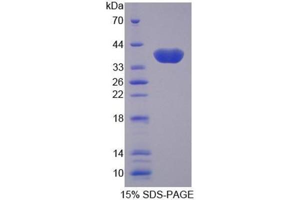 SLC25A11 Protein