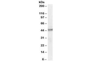 Western blot testing of human testis lysate with STK35 antibody at 1ug/ml. (STK35 Antikörper)